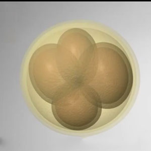 橄榄树生命三代试管婴儿——3D动画演示体外受精过程