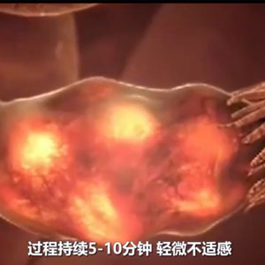 试管婴儿到底有多疼？动画模拟了全过程，看完感叹母爱伟大