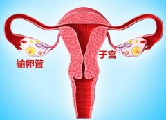 输卵管造影什么人需要？能检查出输卵管积水么？