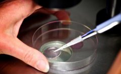 什么是试管婴儿？试管婴儿是怎样取精子的？