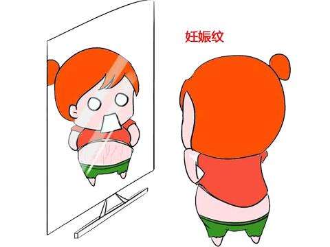 妊娠纹能去掉吗 去妊娠纹最好的产品是哪个