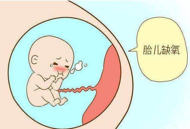 临产胎儿缺氧怎么办