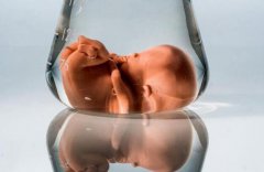 完成7个步骤，你也能拥有自己的试管婴儿