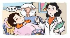 宫外孕手术的费用