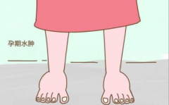 缓解水肿，要对症下药