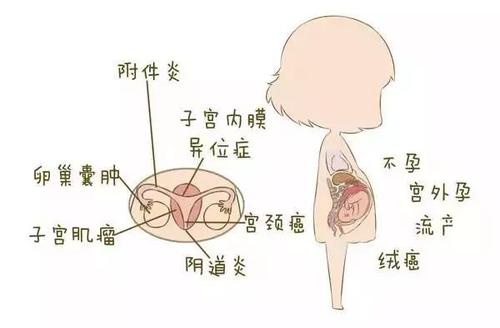 子宫内膜增厚的原因及后果是什么？为什么会出现子宫内膜增厚？