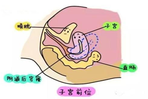 子宫位置前位正常吗？什么是子宫前位？
