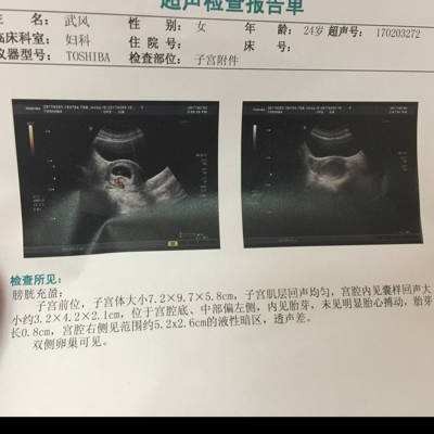 孕期因保胎做了20次b超正常么？怎么做才能做好孕期的保胎？