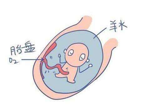 孕期羊水超过多少会很危险