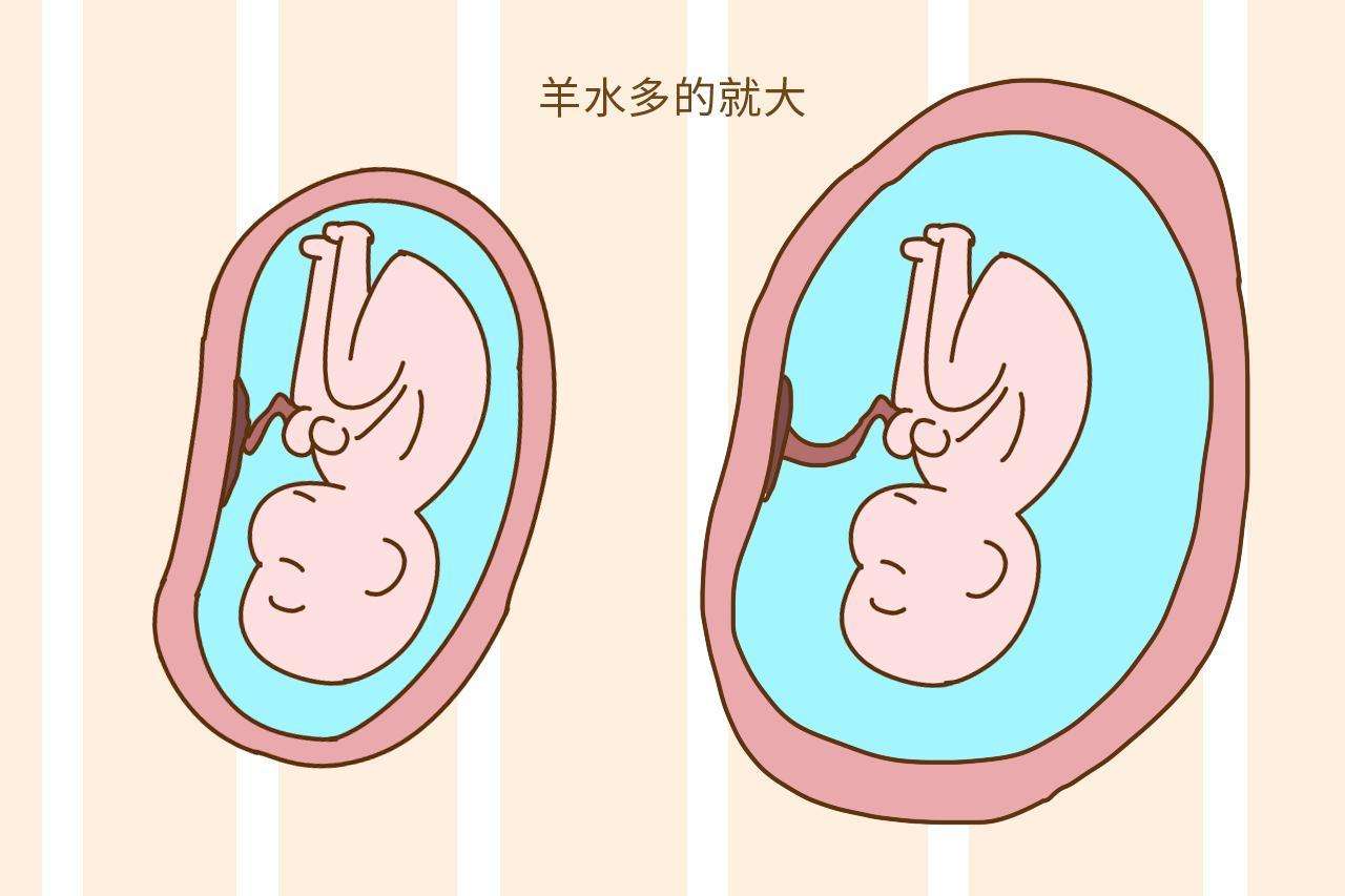 宫腔镜手术会导致不孕吗？术后注意休息别紧张！