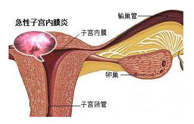 子宫内膜增厚会影响月经吗？子宫内膜厚度和月经有关吗？