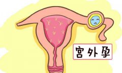 停经与宫外孕之间有何关系？