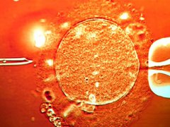 精子不液化做泰国试管婴儿可以吗？影响成功率吗？