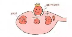 卵泡萎缩是什么原因