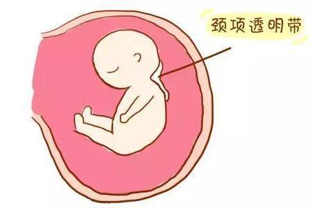 唐氏筛查临界风险是什么意思