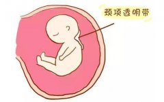 唐氏筛查临界风险是什么意思