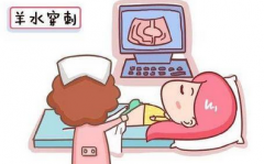 唐氏筛查都查些什么