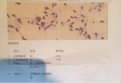 分享我做第三代试管婴儿过程、步骤攻略给大家