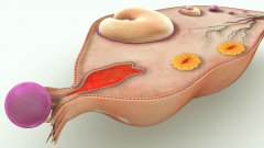 子宫内膜息肉影响怀孕吗？子宫内膜息肉有哪些表现？