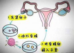 试管婴儿是怎么在体外受精的？