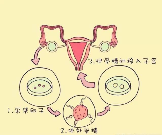 试管婴儿为什么要进行精子洗涤？