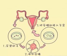 试管婴儿为什么要进行精子洗涤？