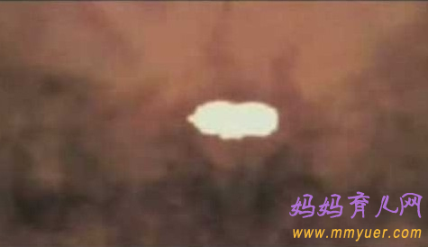 卵子排出全过程 卵子排出的真实图片 
