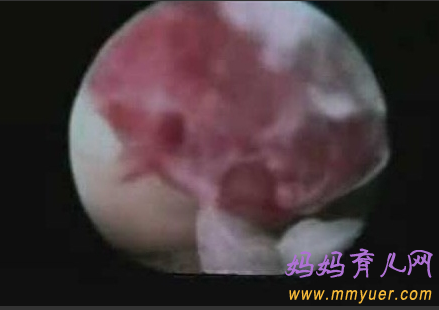 卵子排出全过程 卵子排出的真实图片 