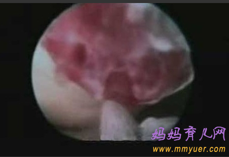 卵子排出全过程 卵子排出的真实图片 