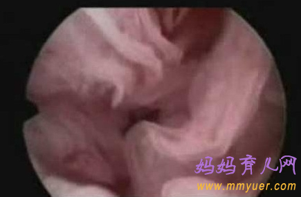 卵子排出全过程 卵子排出的真实图片 