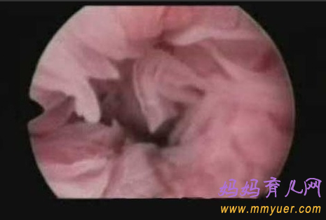 卵子排出全过程 卵子排出的真实图片 