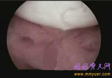 卵子排出全过程 卵子排出的真实图片 