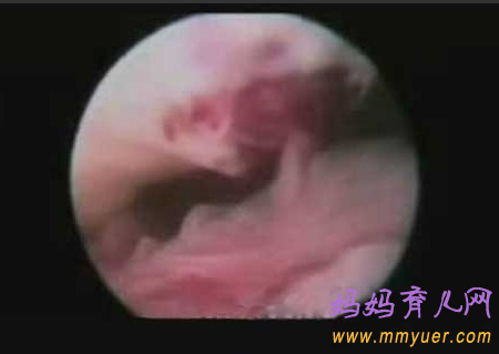 卵子排出全过程 卵子排出的真实图片 