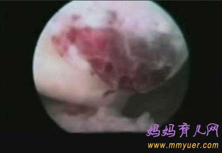 卵子排出全过程 卵子排出的真实图片 
