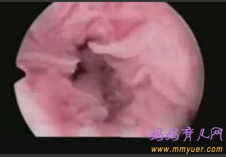 卵子排出全过程 卵子排出的真实图片 
