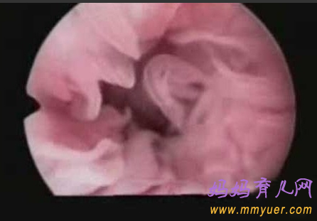 卵子排出全过程 卵子排出的真实图片 