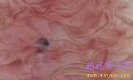 卵子排出全过程 卵子排出的真实图片 