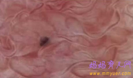 卵子排出全过程 卵子排出的真实图片 