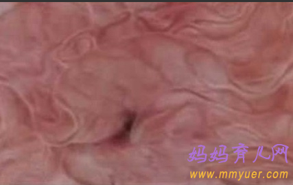 卵子排出全过程 卵子排出的真实图片 
