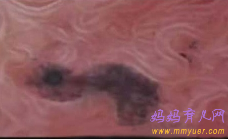 卵子排出全过程 卵子排出的真实图片 
