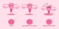 男子精子死精会怀孕吗？成功率有多少？