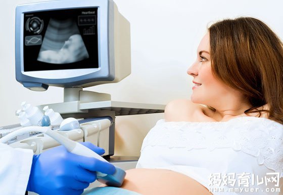 四维单子上有男女暗示 我告诉你四维彩超怎么分辨男女 
