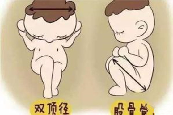 双顶径多少是男孩 双顶径骨股长看男女科学吗 