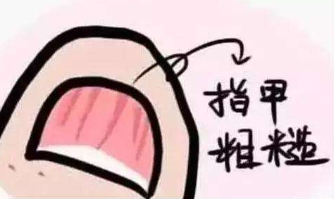指甲凹凸不平有竖纹是什么原因