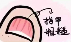 指甲凹凸不平有竖纹是什么原因