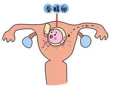 卵巢储备下降和卵巢早衰的区别