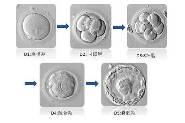 不孕不育做乌克兰试管的流程安排是什么?