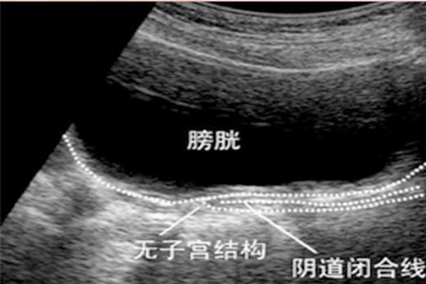 不是虚假宣传!柬埔寨RFG试管婴儿医院重唤石男石女生育梦