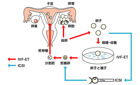 选择恐惧症：去泰国还是马来试管？