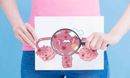 子宫内膜异位症